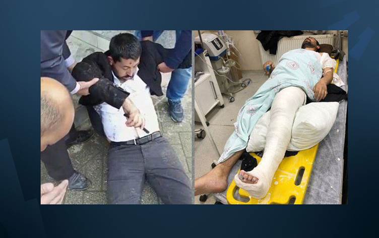 ESKİDEN İŞKENCE KAPALI KAPILAR ARDINDA OLURDU, ŞİMDİ HALKIN GÖZLERİ ÖNÜNDE OLUYOR